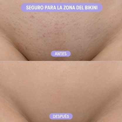 Depiladora de Cristal Exfoliante
