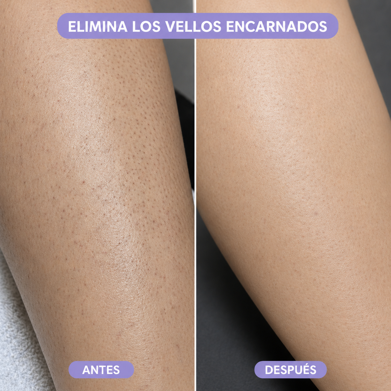 Depiladora de Cristal Exfoliante
